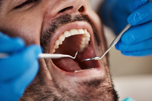 Best Emergency Dental Surgery in Marksville, LA