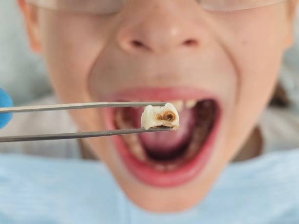 Best Weekend Emergency Dentist in Marksville, LA